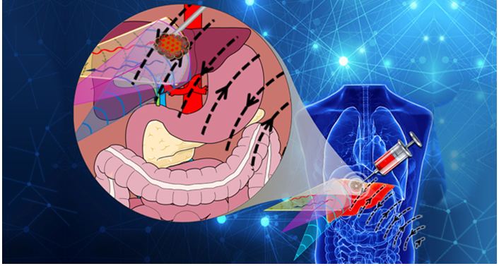 Advances in Drug Delivery Systems and Targeted Therapies